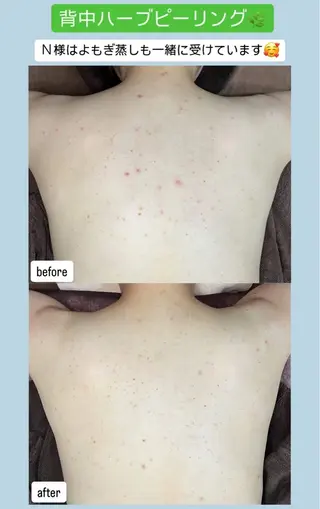 ベラージュ【美背中・ 美尻・フェイシャル】のエステ・リラクイメージ