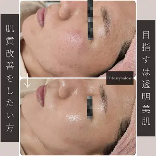 Glossy salonのエステ・リラクイメージ