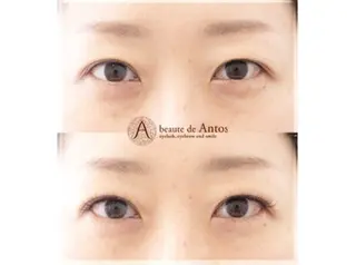 マツエク・マツパ まつげ&眉毛専門店 アントスstaffのマツエク・マツパデザイン