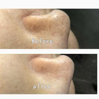 美肌脱毛と癒しのﾌﾟﾗｲﾍﾞｰﾄｻﾛﾝ。gratia~ｸﾞﾚｲﾃｨｱ~所属・gratia ~ｸﾞﾚｲﾃｨｱ~のエステ・リラクイメージ