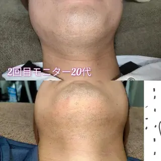 メンズ 武 藤のエステ・リラクイメージ