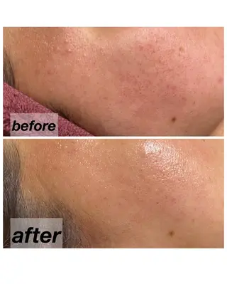 越猪 未来のネイルデザイン