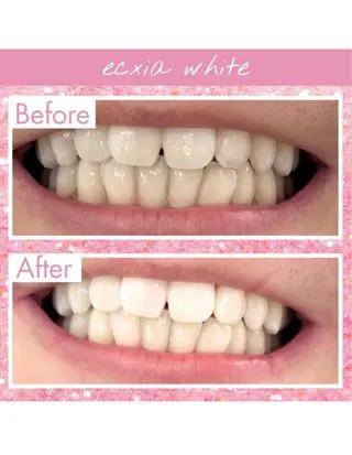 セルフホワイトニングサロン　エクシアホワイト西尾店所属・エクシアホワイト西尾 堀内恵のその他イメージ