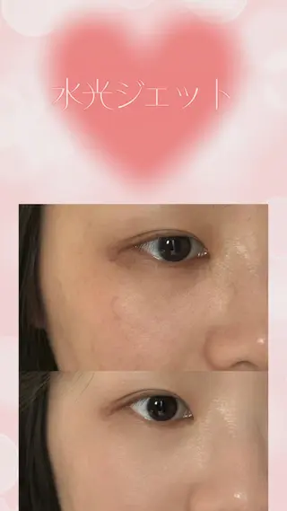 マツエク・マツパ 愛維美水光美肌専門店所属・愛維美水光美肌専門店 メンズレディースokのエステ・リラクイメージ