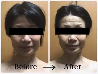 首肩こり専門サロン Kalnicco/カルニッコ所属・首肩こり専門サロン Kalniccoのエステ・リラクイメージ