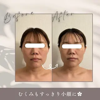 小顔セラピーLIL所属・小顔セラピー LILのエステ・リラクイメージ