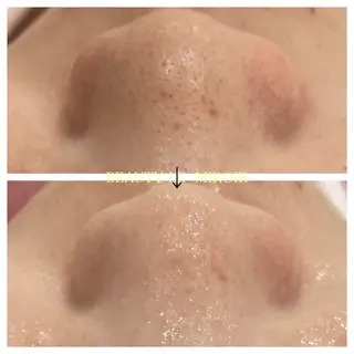 ビューティー ミロワールのエステ・リラクイメージ