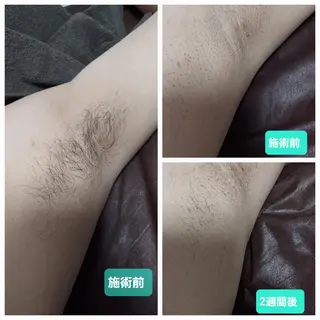 メンズサロンGRACE所属・salon GRACEのエステ・リラクイメージ