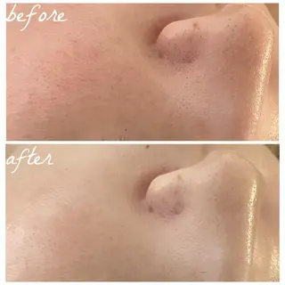 メンズ メナード岐阜茜部 杉浦のエステ・リラクイメージ