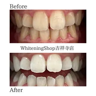 ホワイトニング ショップ吉祥寺店のエステ・リラクイメージ