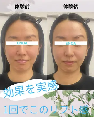 ENOA所属・コルギ/全身リンパ saoriのエステ・リラクイメージ