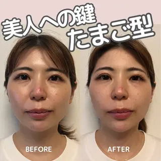 小顔矯正/骨格矯正 AKANEのエステ・リラクイメージ