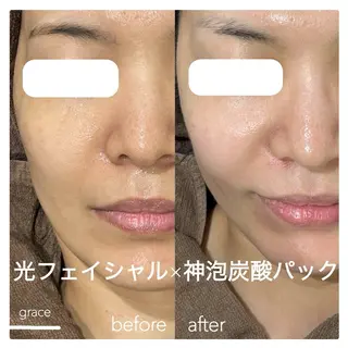 grace ayanoのエステ・リラクイメージ