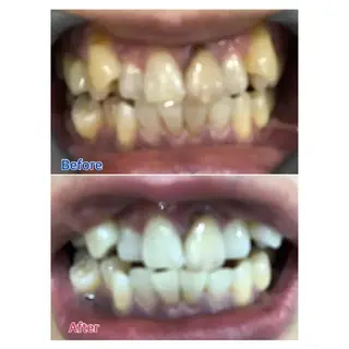 M渋谷店所属・M渋谷 ホワイトニングのエステ・リラクイメージ