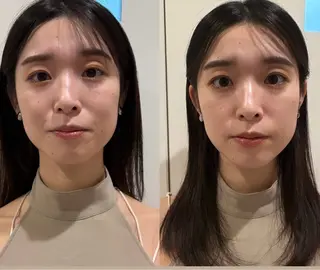 美容鍼灸サロン mahoroba院長のエステ・リラクイメージ