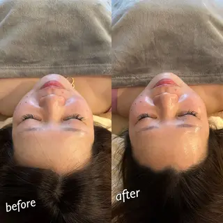 うなじ脱毛/美肌脱毛 LABELのエステ・リラクイメージ