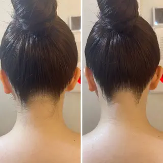 うなじ脱毛/美肌脱毛 LABELのエステ・リラクイメージ