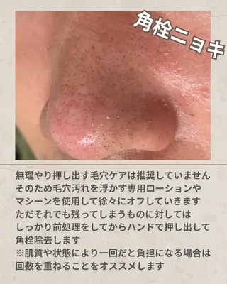 シミ毛穴ケア EsteAのエステ・リラクイメージ