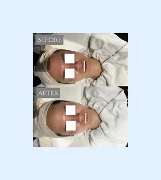 🎀肌質改善🫧 小山のエステ・リラクイメージ