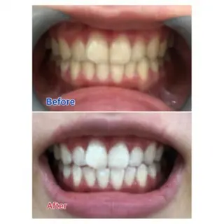 M渋谷店所属・Ｍ渋谷 ホワイトニングのエステ・リラクイメージ