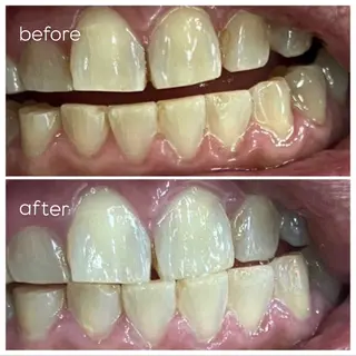 エクシア津駅前店所属・セルフホワイトニング エクシア津駅前店のその他イメージ