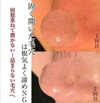 Mignon +所属・Mignon + Natsukiのマツエク・マツパデザイン