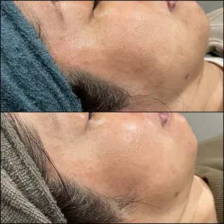 LiZA エステティックサロンのその他イメージ