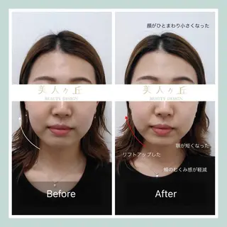 韓国/ヌーディー系 ネイル自由が丘のネイルデザイン