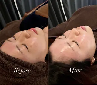 🌼美肌専門 肌質改善🌼のエステ・リラクイメージ