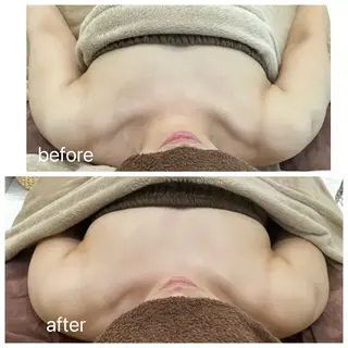 Rene 慢性疲労ケアサロンのエステ・リラクイメージ