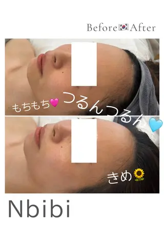 韓国🇰🇷価格 サロン_Nbibiのエステ・リラクイメージ