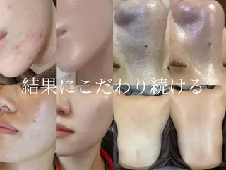 foi sayaのエステ・リラクイメージ