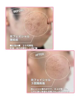 メンズ salonde ReGodのエステ・リラクイメージ