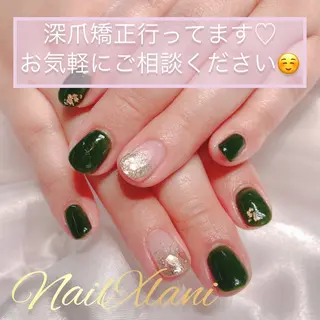 ネイル Nail×Lani 深爪矯正対応◎のネイルデザイン