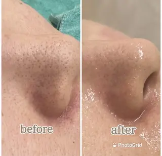 💚THE BALM 金子💚✨のエステ・リラクイメージ