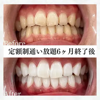 メンズ セルフホワイトニング WHITE福岡博多店のエステ・リラクイメージ