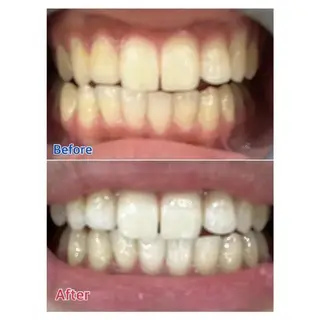 M渋谷店所属・M渋谷 ホワイトニングのエステ・リラクイメージ