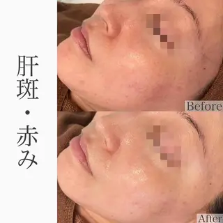 ハーブピーリング専門 BIOEL横浜のエステ・リラクイメージ