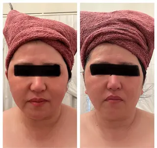 Relative ララティブのエステ・リラクイメージ