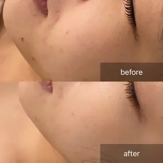 hm NATURESKINのエステ・リラクイメージ