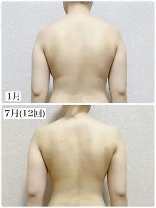 mooi【モーイ】所属・【北堀江】 痩身/小顔　mooiのエステ・リラクイメージ