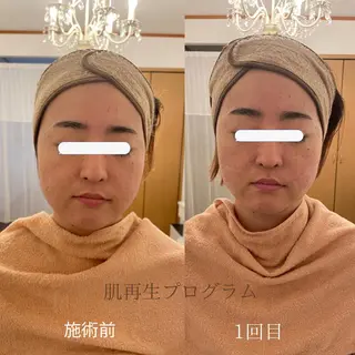 MA CHÉRIE所属・体質別痩身&小顔 MA CHÉRIEのエステ・リラクイメージ