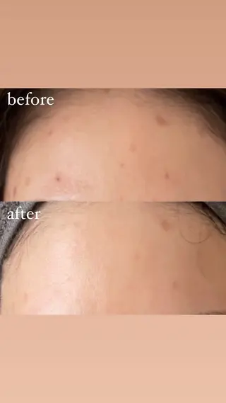 brilliance所属・老化肌トラブル肌専門 Brillianceのエステ・リラクイメージ