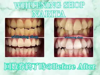 ホワイトニングショップ  成田店所属・ホワイトニング ショップ　成田店のその他イメージ