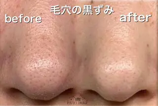 オーガニック エステ サロンフィオーレの眉毛・アイブロウイメージ