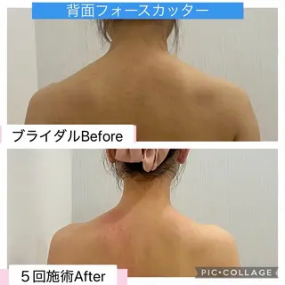 ブライダル痩身×脱毛 尼崎駅前サロンのエステ・リラクイメージ