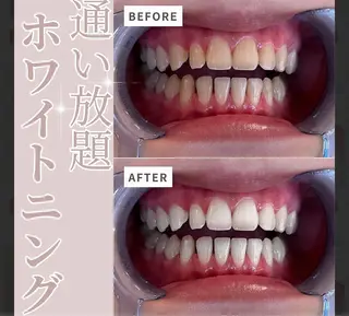 セルフホワイトニング エクシア盛岡中央通店所属・セルフホワイトニング エクシア盛岡あっくんのエステ・リラクイメージ