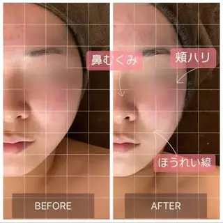 MIRAI小顔　名古屋店所属・MIRAI小顔 名古屋店YUKIのエステ・リラクイメージ