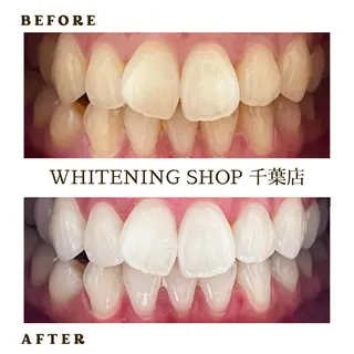 メンズ ホワイトニング ショップ千葉店のその他イメージ