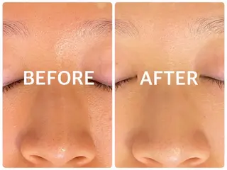 ハーブピーリング 横浜のエステ・リラクイメージ